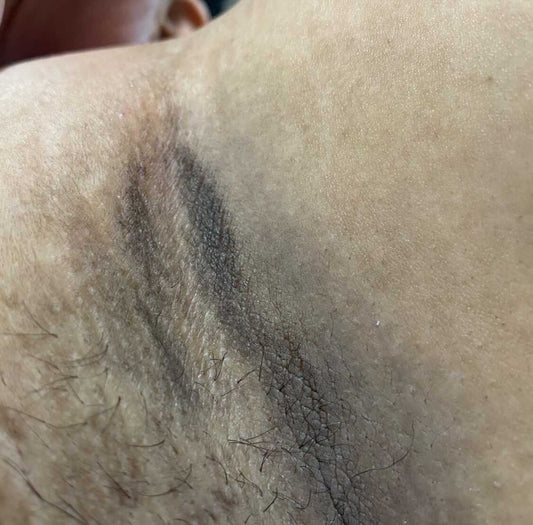 Results After 3 Months