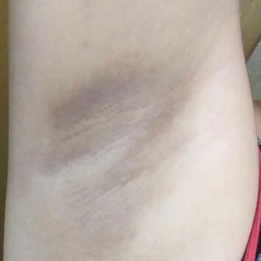 Results After 7 Months