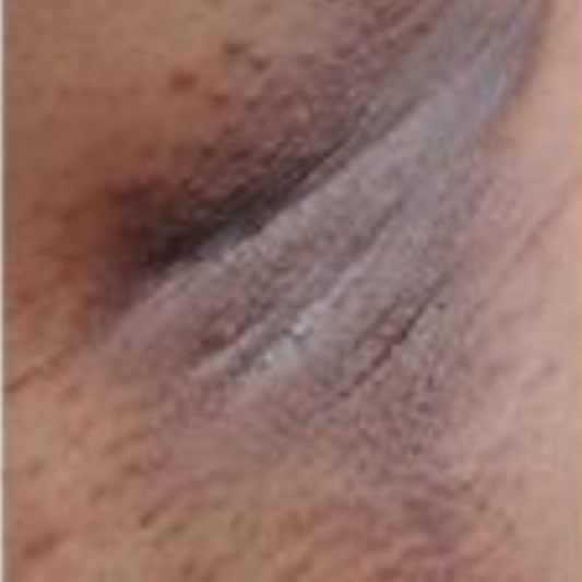 Results After 3 Months