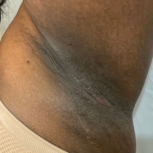 Results After 2 Weeks