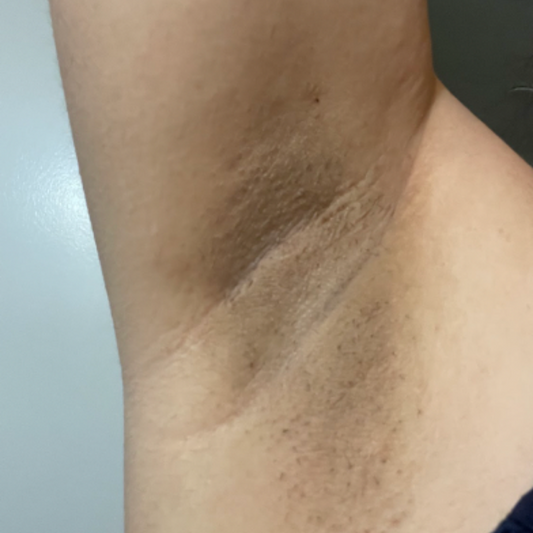 Results After 6 Days