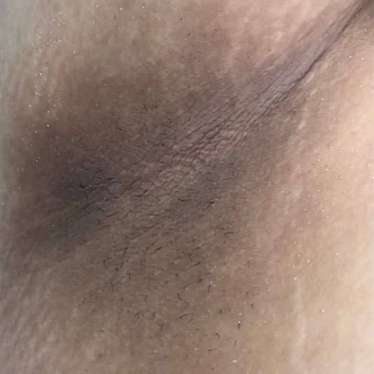 Results After 2 Months