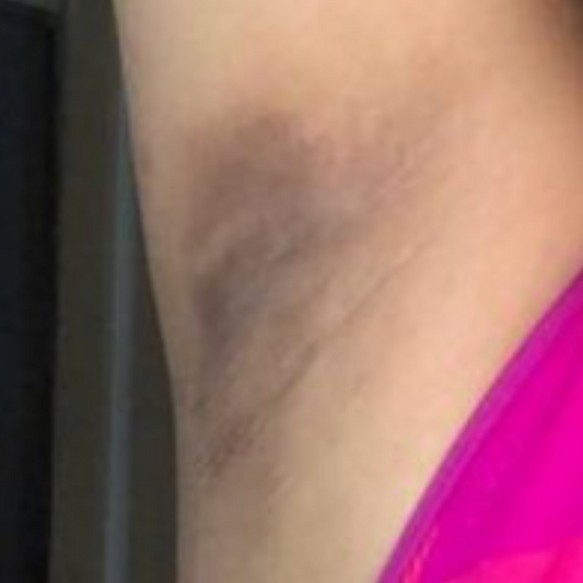 Results After 4 Months