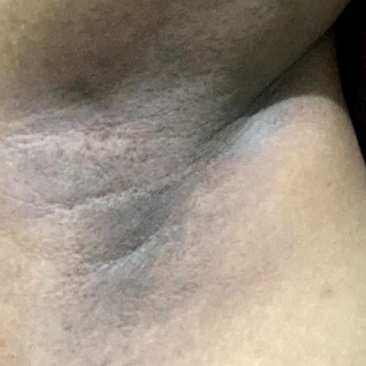 Results After 1 Week