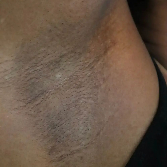 Results After 8 Months