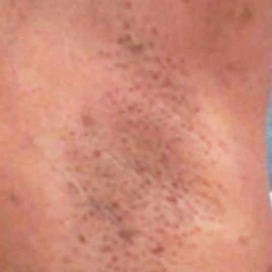 Results After 2 Weeks