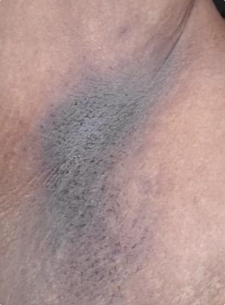 before Image