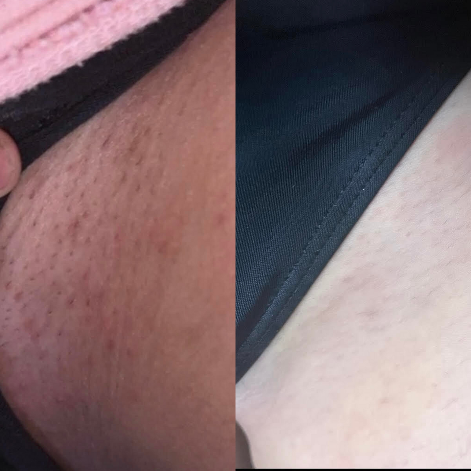 The Smooth & Soothe Inner Thigh Kit – Forgotten Skincare